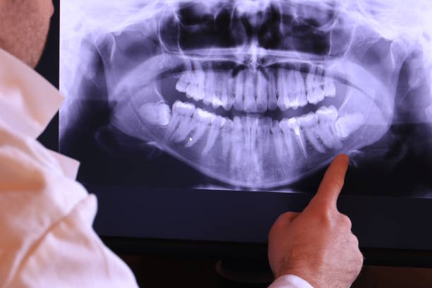 Best Emergency Dental Care for Trauma or Injury in Redding, CA