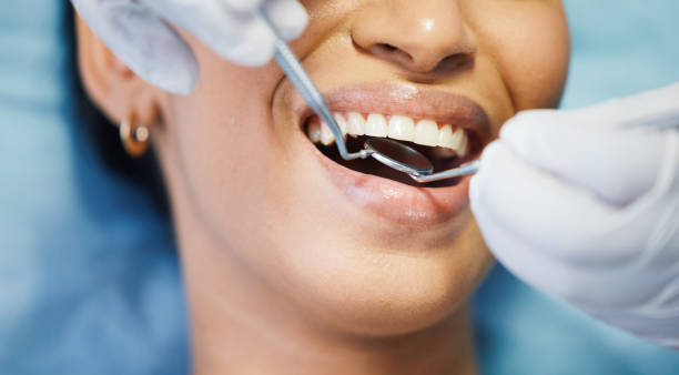Best Emergency Treatment for Toothache in Redding, CA