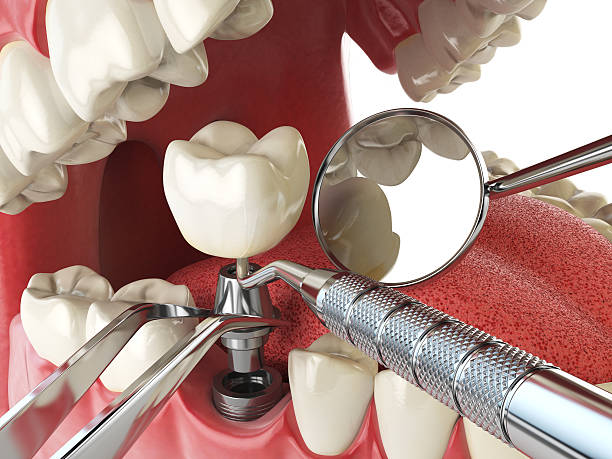 Best Emergency Treatment for Toothache in Redding, CA